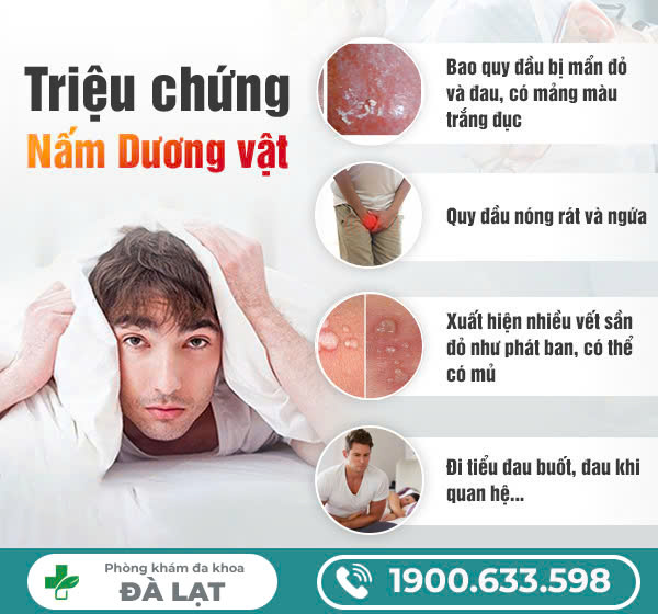 Hình ảnh minh họa